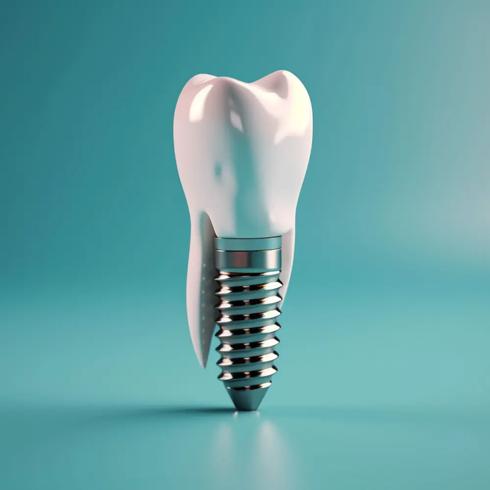 주안역 치과 임플랑트