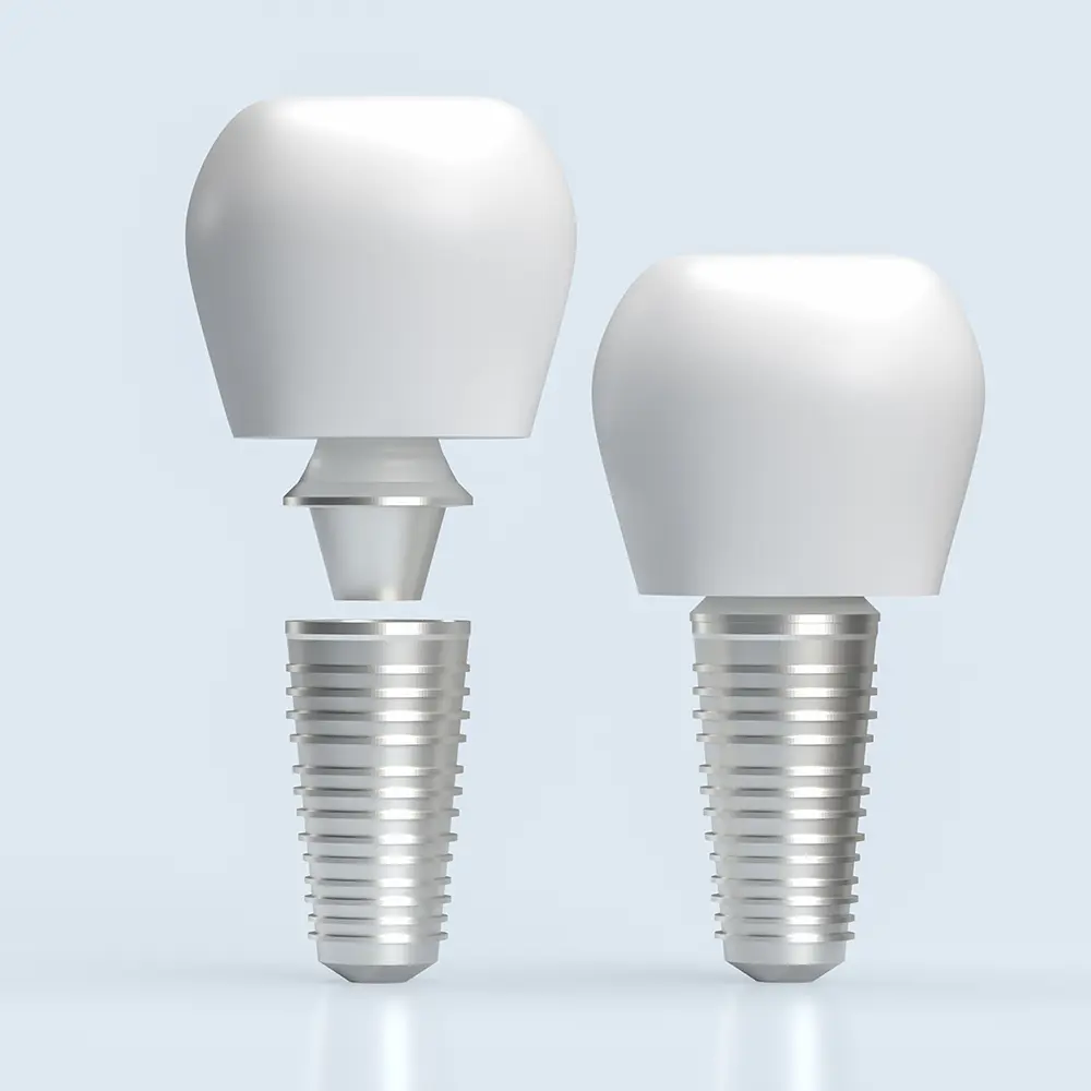 인천 임플란트 저렴한 곳